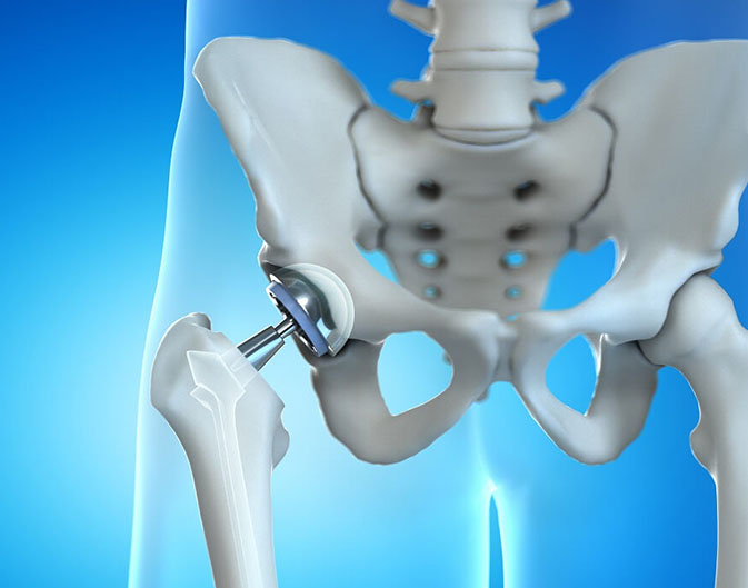 best Orthopedic Surgeon in Lucknow
