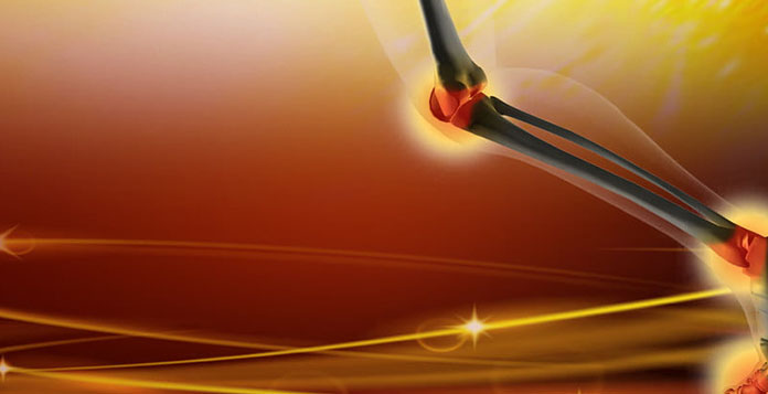 best Orthopedic Surgeon in Lucknow