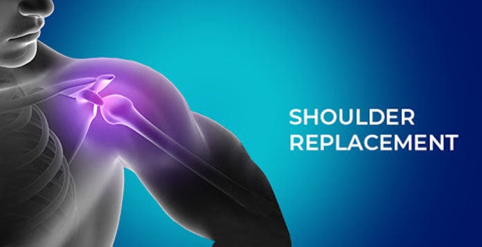 best Orthopedic Surgeon in Lucknow